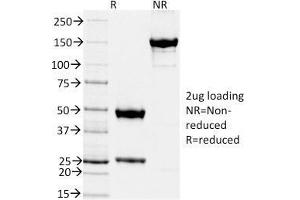 SDS-PAGE Analysis Purified TIMP2 Mouse Monoclonal Antibody (TIMP2/2044).