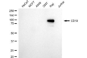 Western blotting analysis using CD19 antibody (ABIN7797956).