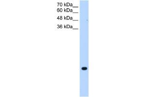 WB Suggested Anti-TMEM75 Antibody Titration:  0. (TMEM75 Antikörper  (C-Term))