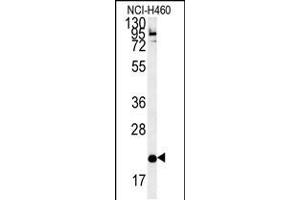 Western blot analysis in NCI-H460 cell line lysates (35ug/lane). (SLAMF7 Antikörper  (AA 58-85))