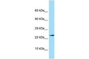 Host:  Rabbit  Target Name:  Il17b  Sample Type:  Rat Pancreas lysates  Antibody Dilution:  1. (IL17B Antikörper  (N-Term))