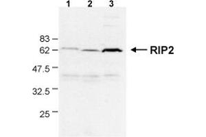 Detection of endogenous human RIP2 in different human cell lines by the MAb to RIP2 (Nick-1) . (RIP2 Antikörper  (AA 1-322))