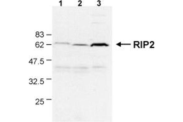 RIP2 抗体  (AA 1-322)