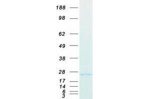Western Blotting (WB) image for Growth Hormone 1 (GH1) (Transcript Variant 2) protein (Myc-DYKDDDDK Tag) (ABIN2732352)