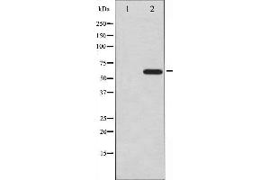 Western blot analysis of CDC25A expression in UV treated A2780 whole cell lysates,The lane on the left is treated with the antigen-specific peptide. (CDC25A Antikörper  (N-Term))