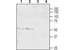 Western blot analysis of mouse (lanes 1 and 3) and rat (lanes 2 and 4) brain lysate: - 1,2. (SLC1A6 Antikörper  (2nd Extracellular Loop))
