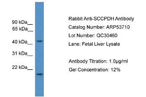 WB Suggested Anti-SCCPDH  Antibody Titration: 0.