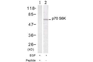 Image no. 2 for anti-Ribosomal Protein S6 Kinase, 70kDa, Polypeptide 1 (RPS6KB1) (Thr389) antibody (ABIN197397) (RPS6KB1 Antikörper  (Thr389))