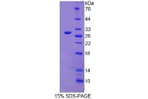 SDS-PAGE (SDS) image for ADP-Ribosyltransferase 4 (Dombrock Blood Group) (ART4) (AA 51-275) protein (His tag) (ABIN4988505) (ART4 Protein (AA 51-275) (His tag))