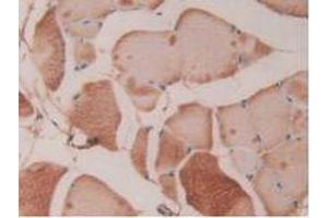 IHC-P analysis of Rat Skeletal Muscle Tissue, with DAB staining. (Fibrillin 1 Antikörper  (AA 751-895))