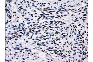 Image no. 13 for anti-Replication Protein A2, 32kDa (RPA2) antibody (ABIN1500736)