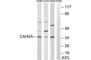 Western Blotting (WB) image for anti-Carbonic Anhydrase VA (CA5A) (Internal Region) antibody (ABIN1851008) (CA5A Antikörper  (Internal Region))