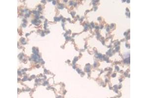 Used in DAB staining on fromalin fixed paraffin- embedded Kidney tissue (FLT1 Antikörper  (AA 18-308))
