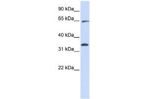 WB Suggested Anti-RHOT1 Antibody Titration:  0. (RHOT1 Antikörper  (Middle Region))