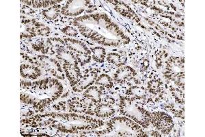 IHC analysis of TRIM24 using anti-TRIM24 antibody (ABIN7602358).