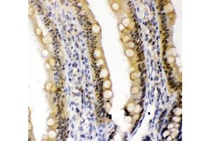 IHC analysis of CRY1 using anti-CRY1 antibody (ABIN3042761). (CRY1 Antikörper  (N-Term))