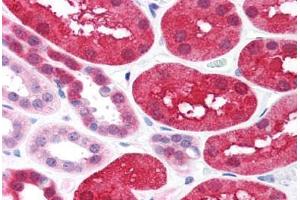 Human Kidney (formalin-fixed, paraffin-embedded) stained with XIAP antibody ABIN214586 at 2 ug/ml followed by biotinylated goat anti-rabbit IgG secondary antibody ABIN481713, alkaline phosphatase-streptavidin and chromogen. (XIAP Antikörper  (C-Term))