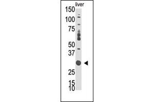 Western Blotting (WB) image for anti-Docking Protein 5 (DOK5) (N-Term) antibody (ABIN359962) (DOK5 Antikörper  (N-Term))