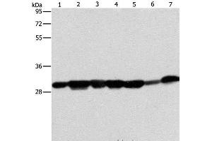 Western Blot analysis of Human placenta tissue and A549 cell, Mouse brain tissue and hepG2 cell, Raji cell and Human fetal liver tissue, hela cell using AK2 Polyclonal Antibody at dilution of 1:300