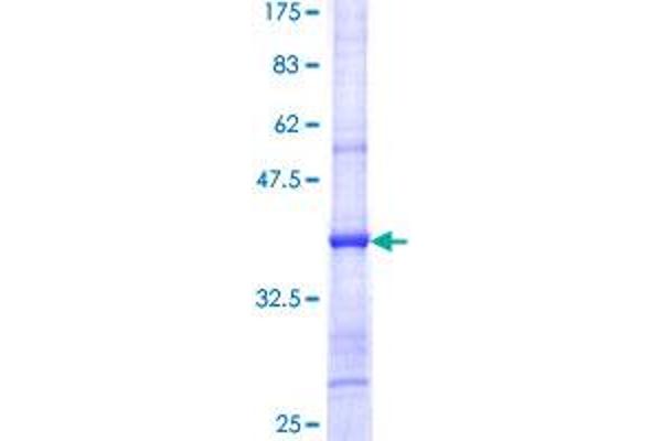 EIF4E2 Protein (AA 146-245) (GST tag)