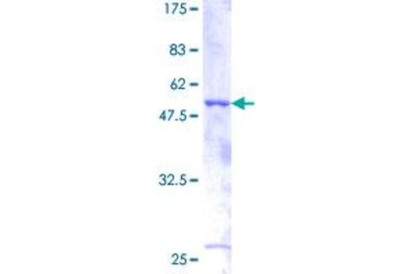 Betacellulin Protein (BTC) (AA 1-178) (GST tag)