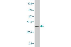 Western Blot detection against Immunogen (36. (KAT2A Antikörper  (AA 738-837))