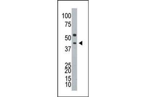 Image no. 1 for anti-Ataxin 3 (ATXN3) (N-Term) antibody (ABIN357621) (Ataxin 3 Antikörper  (N-Term))