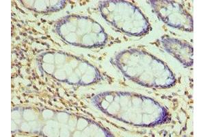 Immunohistochemistry of paraffin-embedded human colon tissue using ABIN7155385 at dilution of 1:100 (H2AFZ Antikörper  (AA 1-128))