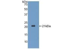 Detection of Recombinant DPT, Human using Polyclonal Antibody to Dermatopontin (DPT) (Dermatopontin Antikörper  (AA 26-197))