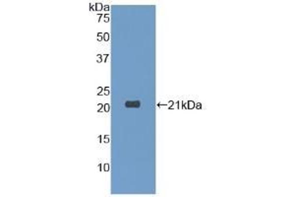Dermatopontin Antikörper  (AA 26-197)