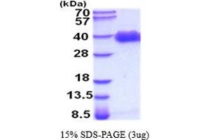 SDS-PAGE (SDS) image for delta-Like 1 Homolog (Drosophila) (DLK1) (AA 24-303) protein (His tag) (ABIN5854443) (DLK1 Protein (AA 24-303) (His tag))