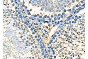 ABIN7093914 and ABIN7097958 at 1/100 staining Rat kidney tissue by IHC-P. (MED12 Antikörper  (Internal Region))