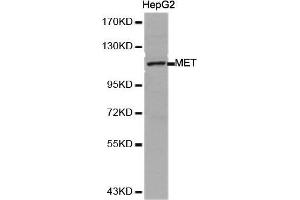 Western Blotting (WB) image for anti-Met Proto-Oncogene (MET) (AA 25-325) antibody (ABIN6213594) (c-MET Antikörper  (AA 25-325))