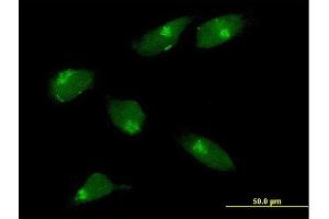 Immunofluorescence of purified MaxPab antibody to MGAT1 on HeLa cell. (MGAT1 Antikörper  (AA 1-445))