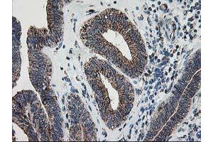 Image no. 3 for anti-Dihydrolipoamide Dehydrogenase (DLD) antibody (ABIN1497845) (DLD Antikörper)