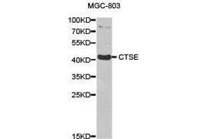 Western Blotting (WB) image for anti-Cathepsin E (CTSE) antibody (ABIN1872100) (Cathepsin E Antikörper)