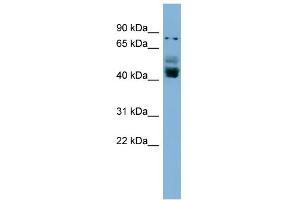 WB Suggested Anti-ZNF620 Antibody Titration:  0. (ZNF620 Antikörper  (N-Term))