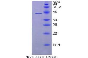 SDS-PAGE analysis of Mouse C8b Protein. (C8B Protein)