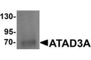 Western blot analysis of ATAD3A in Daudi cell lysate with ATAD3A antibody at 1 μg/ml (ATAD3A Antikörper  (N-Term))
