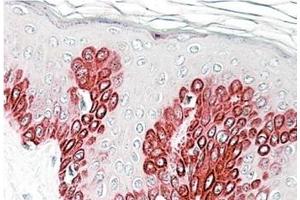 AP23761PU-N SIRT1 antibody staining of paraffin embedded Human Skin at 3. (SIRT1 Antikörper  (Internal Region))