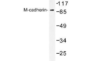Image no. 1 for anti-M-Cadherin (CDH15) antibody (ABIN272294) (CDH15 Antikörper)