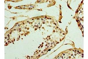 Immunohistochemistry of paraffin-embedded human testis tissue using ABIN7159831 at dilution of 1:100 (UCP1 Antikörper  (AA 1-307))