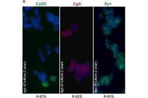 Immunofluorescence (Cultured Cells) (IF (cc)) image for anti-Synaptophysin (SYP) (C-Term) antibody (ABIN2854881)