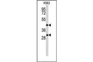Western blot analysis of DFFA / ICAD Antibody (C-term) in K562 cell line lysates (35ug/lane). (DFFA Antikörper  (C-Term))