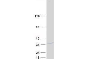 Validation with Western Blot (DSCR3 Protein (Myc-DYKDDDDK Tag))