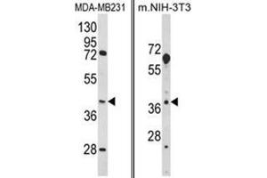 (LEFT) Western blot analysis of HOMER3 Antibody (Center) in MDA-MB231 cell line lysates (35ug/lane). (HOMER3 Antikörper  (Middle Region))
