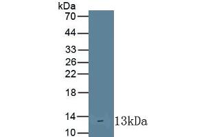 Detection of Recombinant IL10Ra, Human using Monoclonal Antibody to Interleukin 10 Receptor Alpha (IL10Ra) (IL-10RA Antikörper  (AA 132-235))