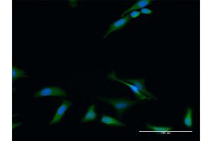 Immunofluorescence of purified MaxPab antibody to RIOK2 on HeLa cell. (RIOK2 Antikörper  (AA 1-552))