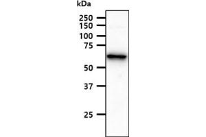 The HepG2 cell lysate (40ug) were resolved by SDS-PAGE, transferred to PVDF membrane and probed with anti-human ACSF2 antibody (1:1000). (ACSF2 Antikörper)