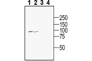 Western blot analysis of human Malme-3M melanoma cell line lysate (lanes 1 and 3) and human Colo-205 colorectal adenocarcinoma cell line lysate (lanes 2 and 4):1-2.
